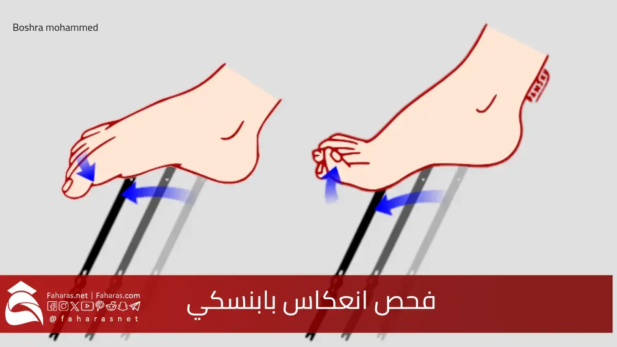 صورة توضح طريقة فحص منعكس بابنسكي