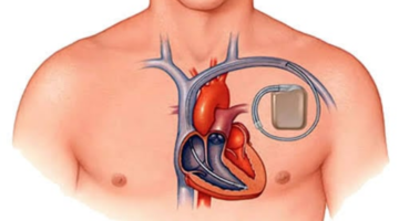 How much does heart battery cost Kuwait 20